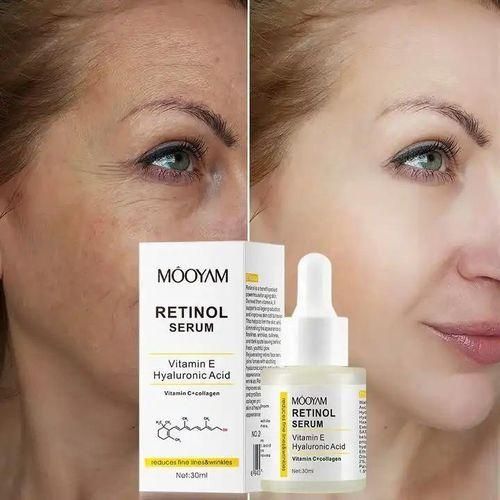 Anti-aging Retinol Serum with Hyaluronic Acid Vitamin E - Reduce Wrinkles Lifting Firming Retinol