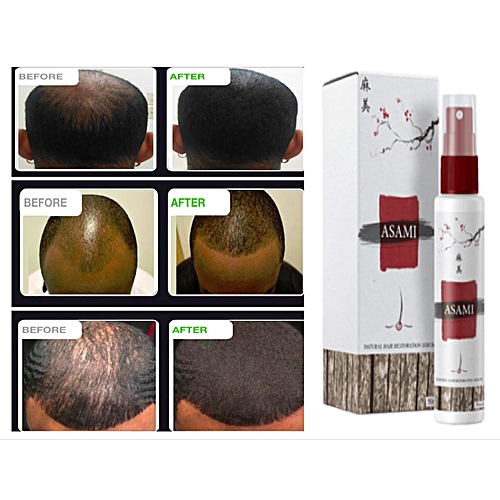 Asami Hair Growth Spray For Men