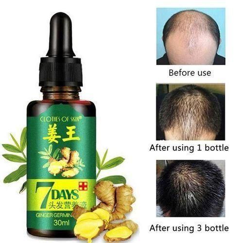 Original Hair Growth Oil Ginger Hair Scalp Strengthening Hair Growth Essence_30ml