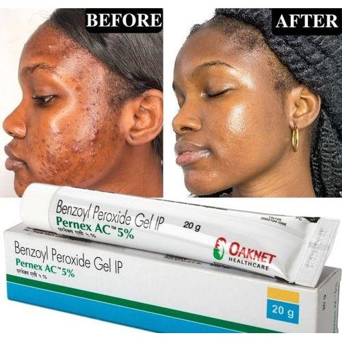 Benzoyl Peroxide Gel With Pernex AC 5 20g