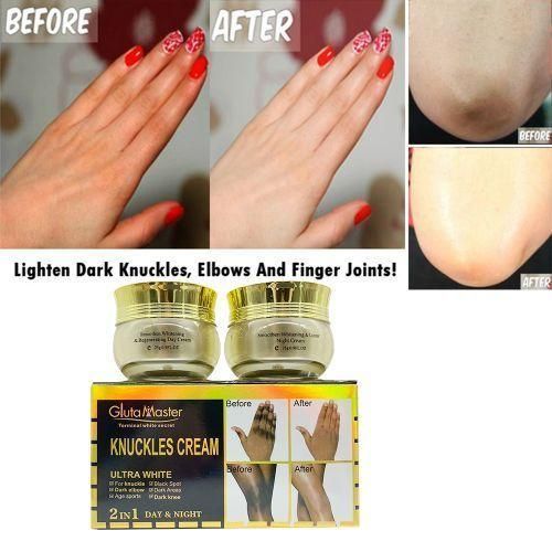 Master 2in1 Effective Dark Knuckles Spot Lightening Cream