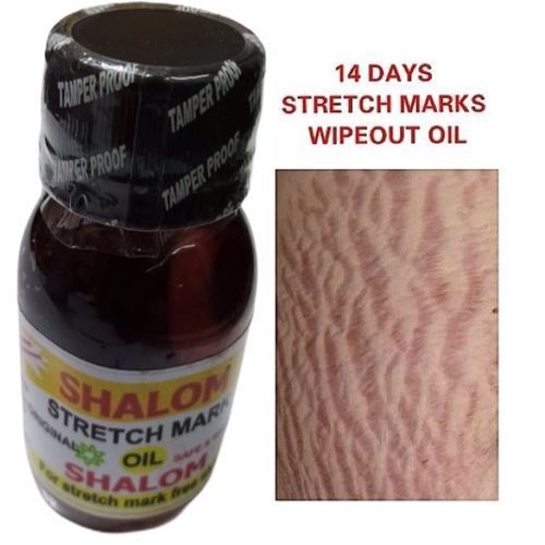 Stretch Mark Wipe Out Treatment Oil