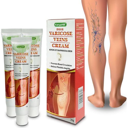 Kanyehb Varicose Veins Cream, Spider Cream for Varicose Veins, Vein Comfort Anti Varicose Herbal Treatment Cream, Removal of Varicose Veins, Relieve Pain and Itching 20G