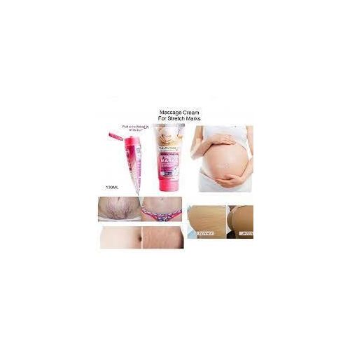 stretch mark cream