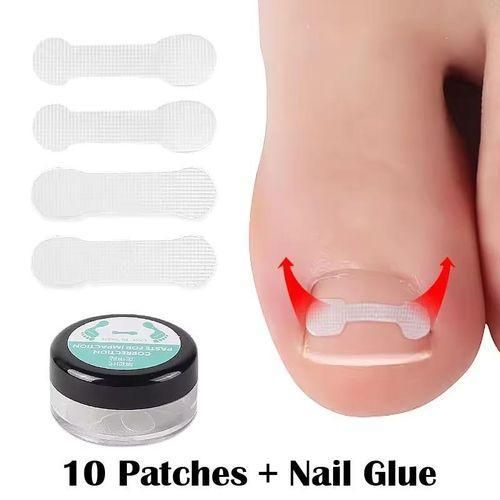 10pcs/box Ingrown Toe Nail Correction Sticker Patches Correction File Acronyx Wire Corrector Foot Care