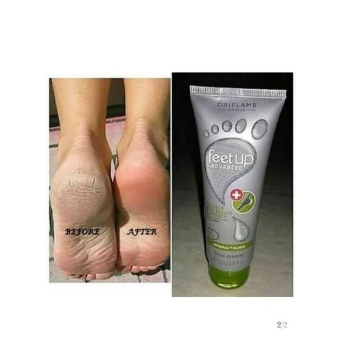 Feet up advanced cracked Repair foot