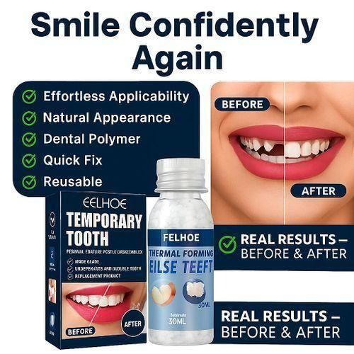 Moldable False Teeth - Thermal Forming Temporary Tooth Replacement & Repair - Instant Smile Repair
