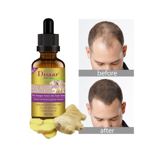 Restore Hair In Baldness Hair Regrowth Anti Hair Loss Ginger Oil