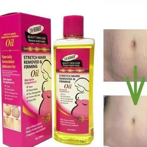 Stretch Mark Remover Oil Skin Firming Clears Stretch Marks