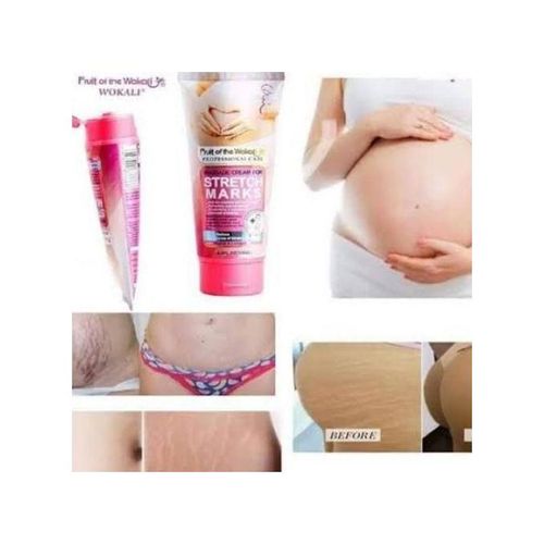 Massage Cream For Stretch Marks Remover,