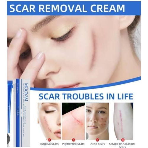 SCAR REMOVAL CREAM