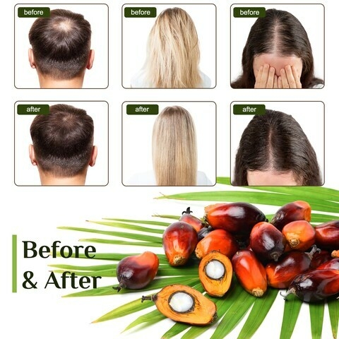 Buy Raw Batana Oil for Hair Growth Batana Oil Organic for ...