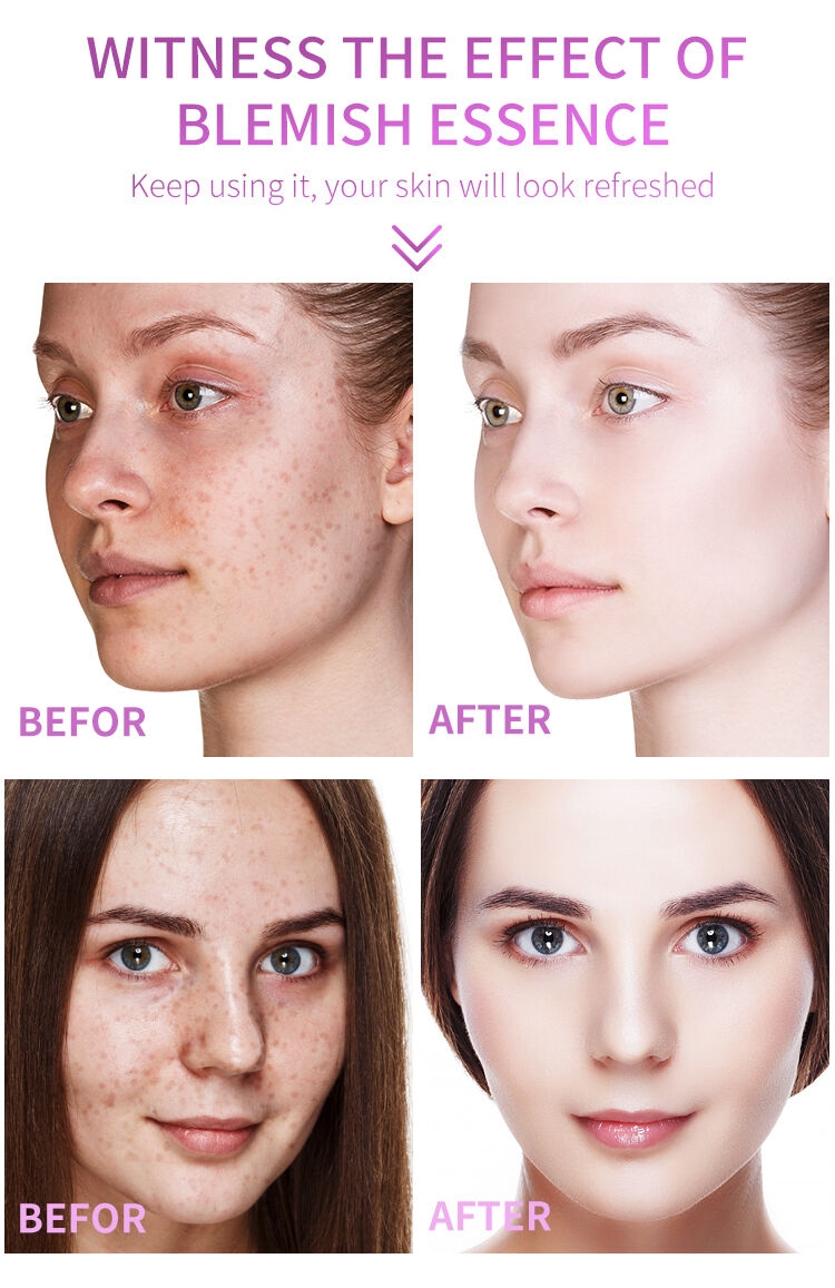 2021 DR RASHEL Products 30ml Vitamin E Dark Spots Corrector Face Serum