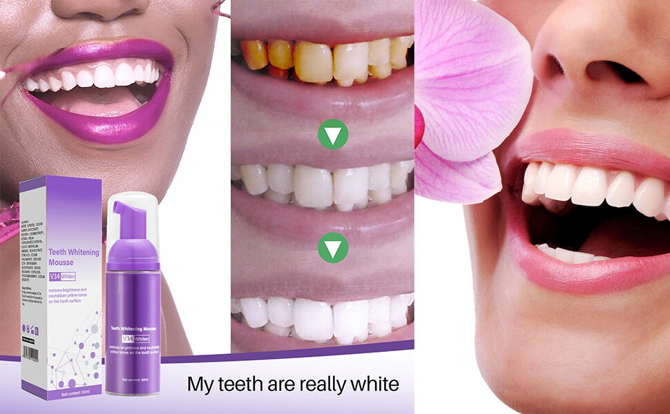 teeth whitening mousse