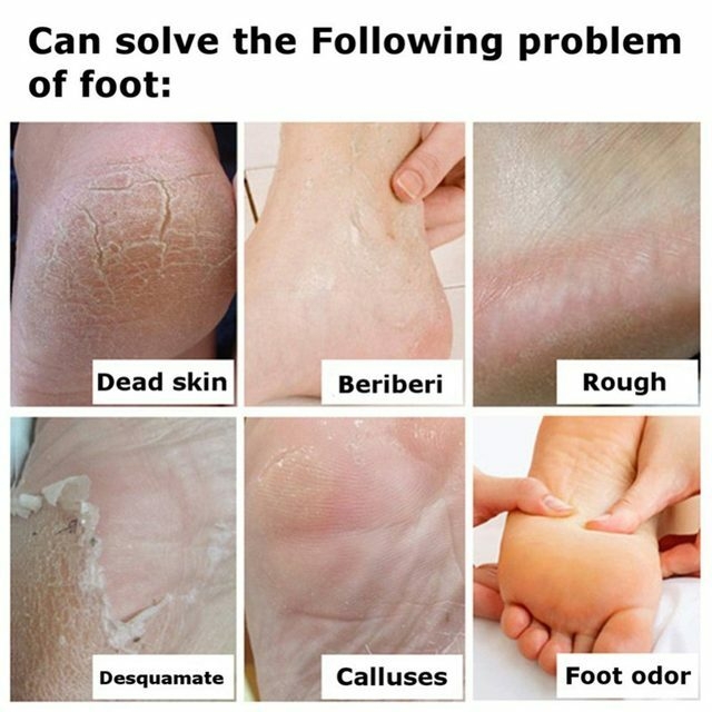 HTB1EhE4cxtnkeRjSZSgq6xAuXXab