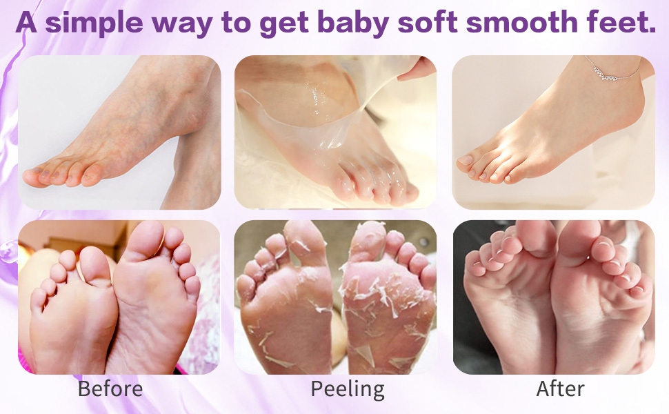 Peeling and exfoliating foot mask for baby soft feet