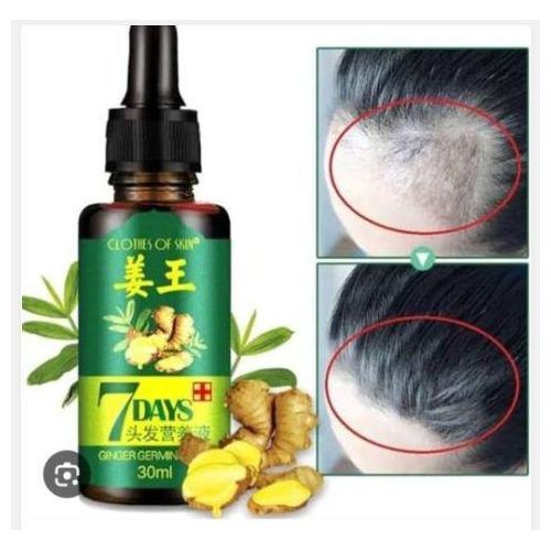 Ginger Germinal Hair Beard Oil Growth loss Essence oil faste