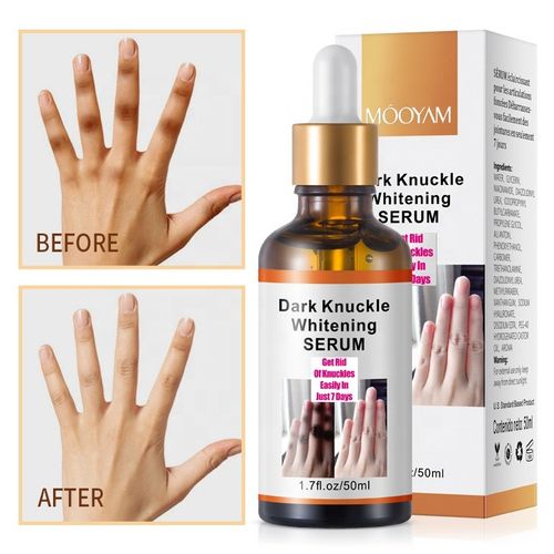 Original Whitening Knuckles Remover Serum Dark Spots Corrector Skin Lightening