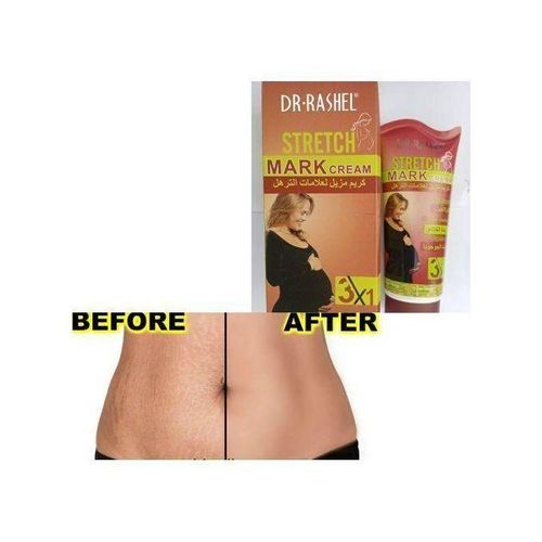 Stretchmark Removal Cream Stretchmark Removal Cream