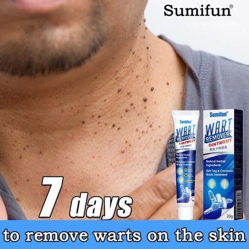 Warts Remover (3PCS)