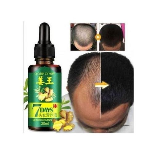 Gluta-Magic Hair Tonic Ginger Germinal Growth Oil-30ml---