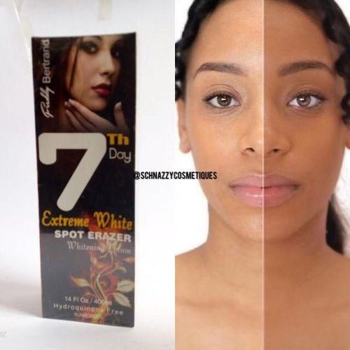 7TH DAY SPOT ERASER LOTION STRETCHMARKS BRIGHTEN EVEN TONE