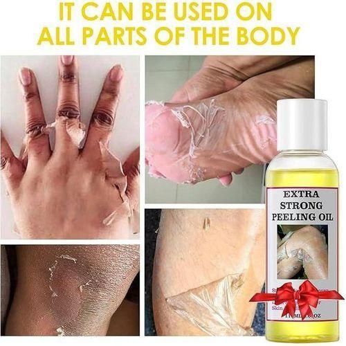 MOOYAM Body Exfoliate Peeling Oil, Yellow Peeling Oil, Peeling Oil for Dark Skin, Yellow Peeling Oil with Salicylic Sodium Hyaluronate, Exfoliating Peeling Solution for Body