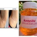 Kennite Dark Elbow, Thighs And Knuckles Gel
