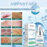 product_image_name-Pansly-Scar Gel-1