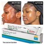 OAKNET Benzoyl Peroxide Gel With Pernex AC 5% 20g