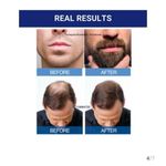 product_image_name-Kirkland-Signature Minoxidil 5% Topical Solution - Extra Strength Hair Regrowth Treatment for Men - 60ml (1 Month Supply)-4