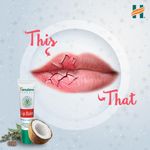 product_image_name-Generic-Lip Balm nourishes lips-4