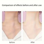 product_image_name-Generic-Neck Face Massager Anti-Wrinkle Face Device-8