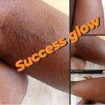 product_image_name-Bel Eclat-Kenacol oil-3