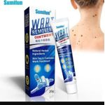 Sumifun wart and tag skin remover