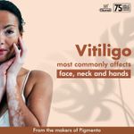 product_image_name-Generic-Pigmento Ointment 50g-2