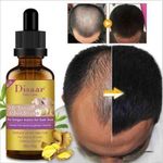 Hair Growth In Baldness Essential Oil -Anti Hair Loss -30ml