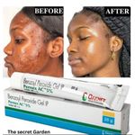 OAKNET  Benzoyl Peroxide Gel With Pernex AC 5% 20g