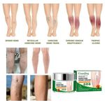 product_image_name-Guanjing-Varicose veins cream -5