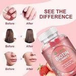 product_image_name-Generic-BIOTIN GUMMIES WITH COLLAGEN, KERATIN & VITAMIN C-2