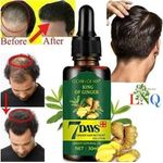 product_image_name-Generic-Fast Hair Growth Oil Ginger Natural Hair Growth Essence Hair Strengthening Anti-Hair Loss Oil _30ml-1