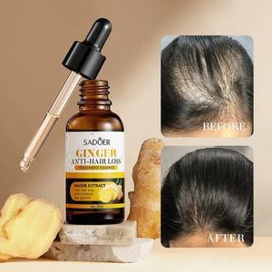 SADOER Anti Hair Loss Serum, Hair Growth Serum