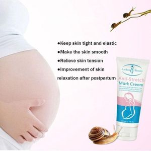 Aichun Beauty  Anti-stretch Mark Cream, 60g for stuborn stretch marks