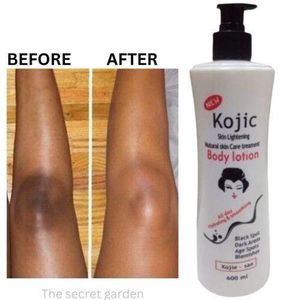 Kojic Skin Lightening And Brightening ,Black Spots/age Spots/dark Areas Remover Body Lotion