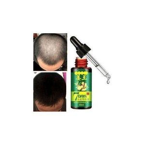 Aichun Beauty    7 Days Hair Tonic Ginger Germinal Regrowth Oil