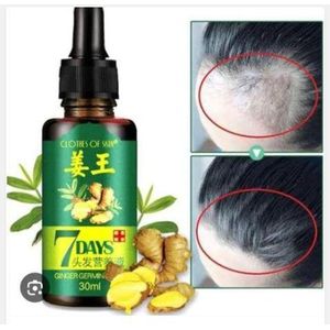 Clothes Of Skin 7 Day King Of Ginger 7 Days Ginger Germinal Oil Hair Growth Care