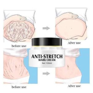 Aichun Beauty   3 Days Effective Stretch Marks Removal Cream