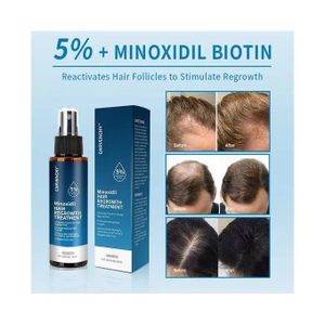Carvenchy Minoxidil Hair Regrowth Treatment 5% With Biotin Potent Hair Revitalization Formula High Performance Scalp Treatment To Fortify Follicles Minimize Thinning And Enhance Natural Volume