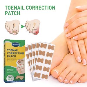 INGROWN TOENAIL TREATMENT  Ingrowing Toe Nail Correction Tool