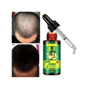 Aichun Beauty   7 Days Hair Tonic Ginger Germinal Regrowth Oil